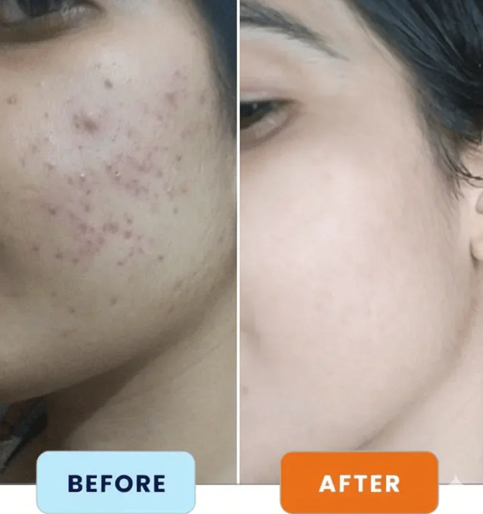 GlutaMin Full Body Whitening Capsules – 20 Days - Derma Essence